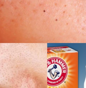 How to Remove Blackheads with Baking Soda: A Simple DIY Guide